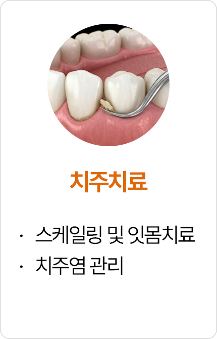치주치료