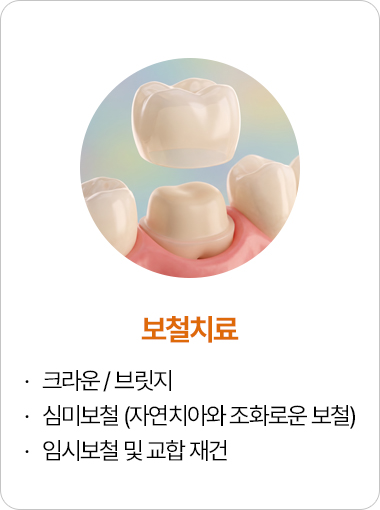 보철치료